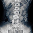 Night Skinny - Mattoni X Ray